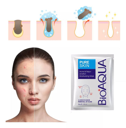 DermaShot  - Mascarilla Antiacne Bioqua X5